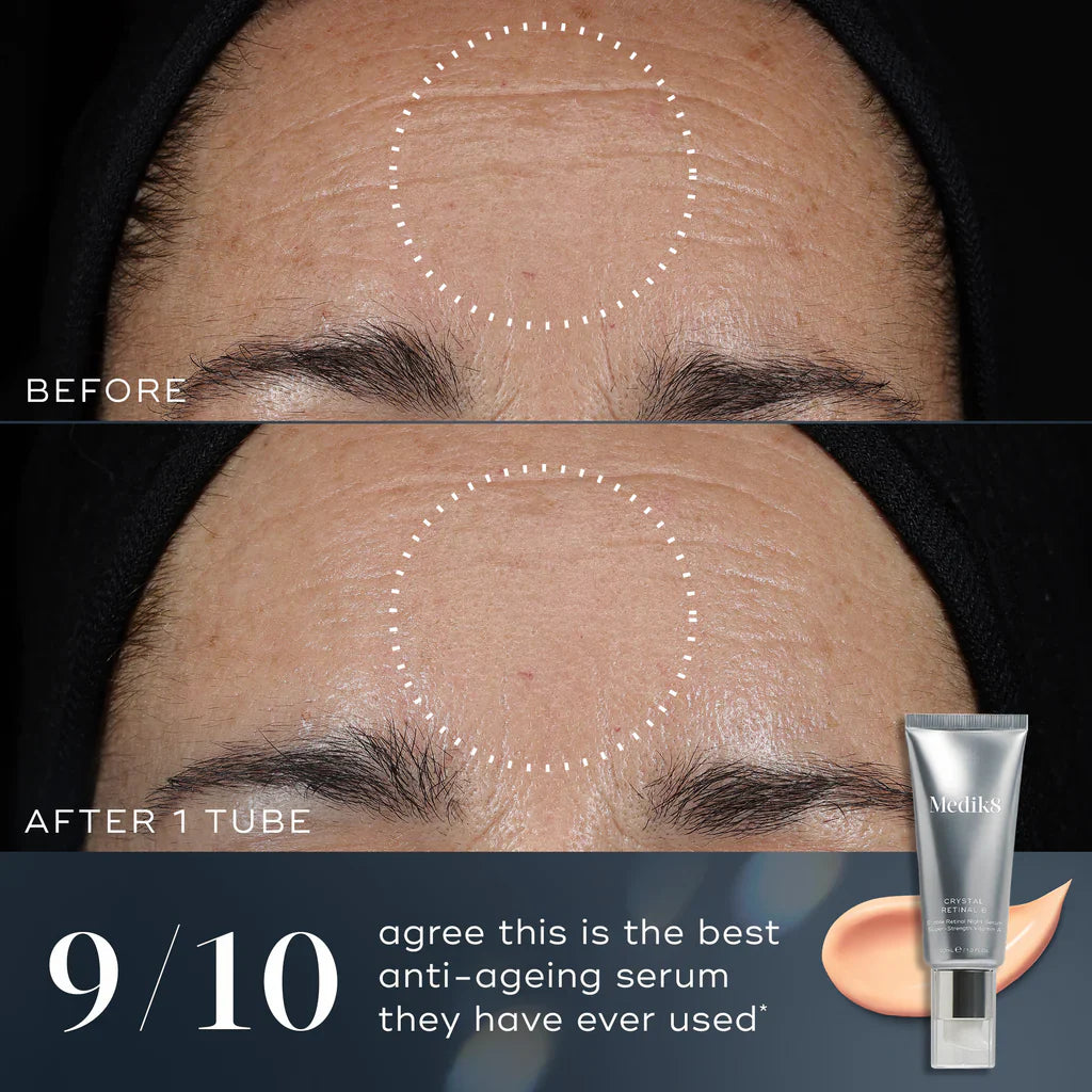Medik8 Crystal Retinal 24 before and after