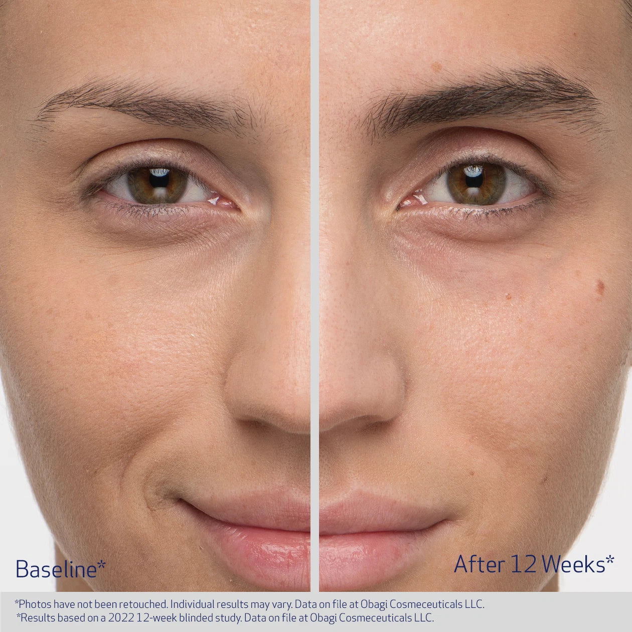 Obagi Nu Cil Eyebrow serum before and after