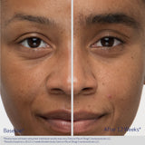Obagi Nu Cil Eyebrow serum before and after