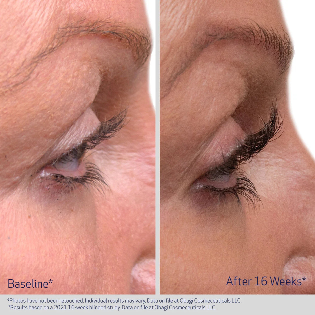 Obagi Nu Cil Eyelast Serum results