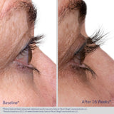 Obagi Nu Cil Eyelast Before and After
