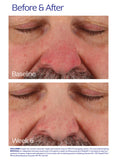ZO Skin Health® Rozatrol