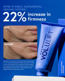 vol.u.lift before and after