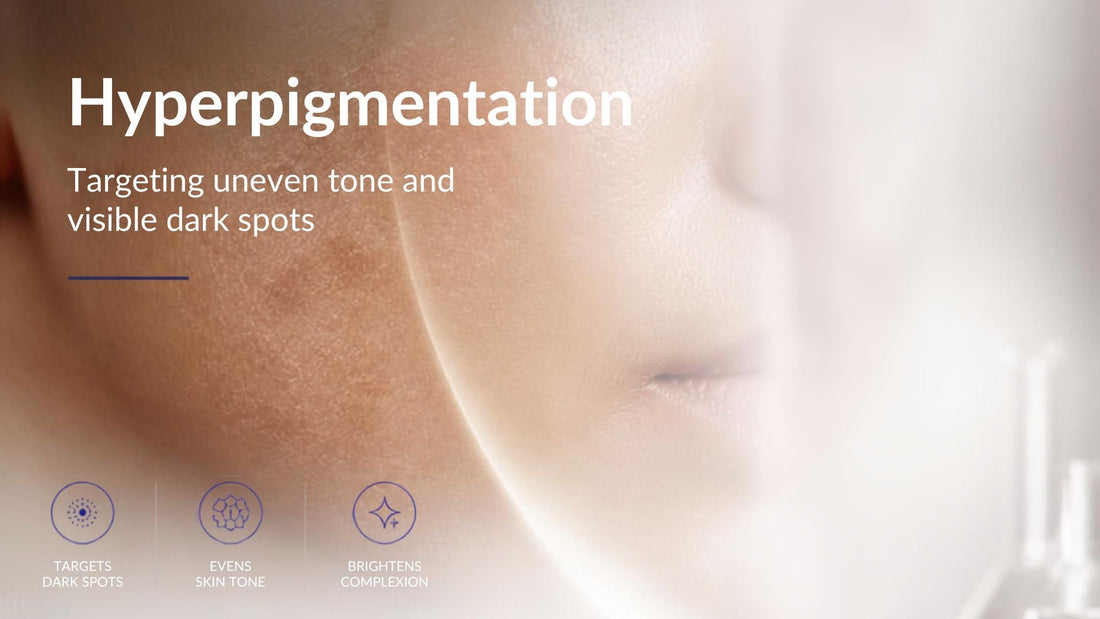 ZO Skin Health® for Hyperpigmentation: A Clinical Guide