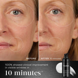 Medik8 Liquid peptides Advanced MP Before and after 2