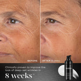 Medik8 Liquid peptides Advanced MP Before and After