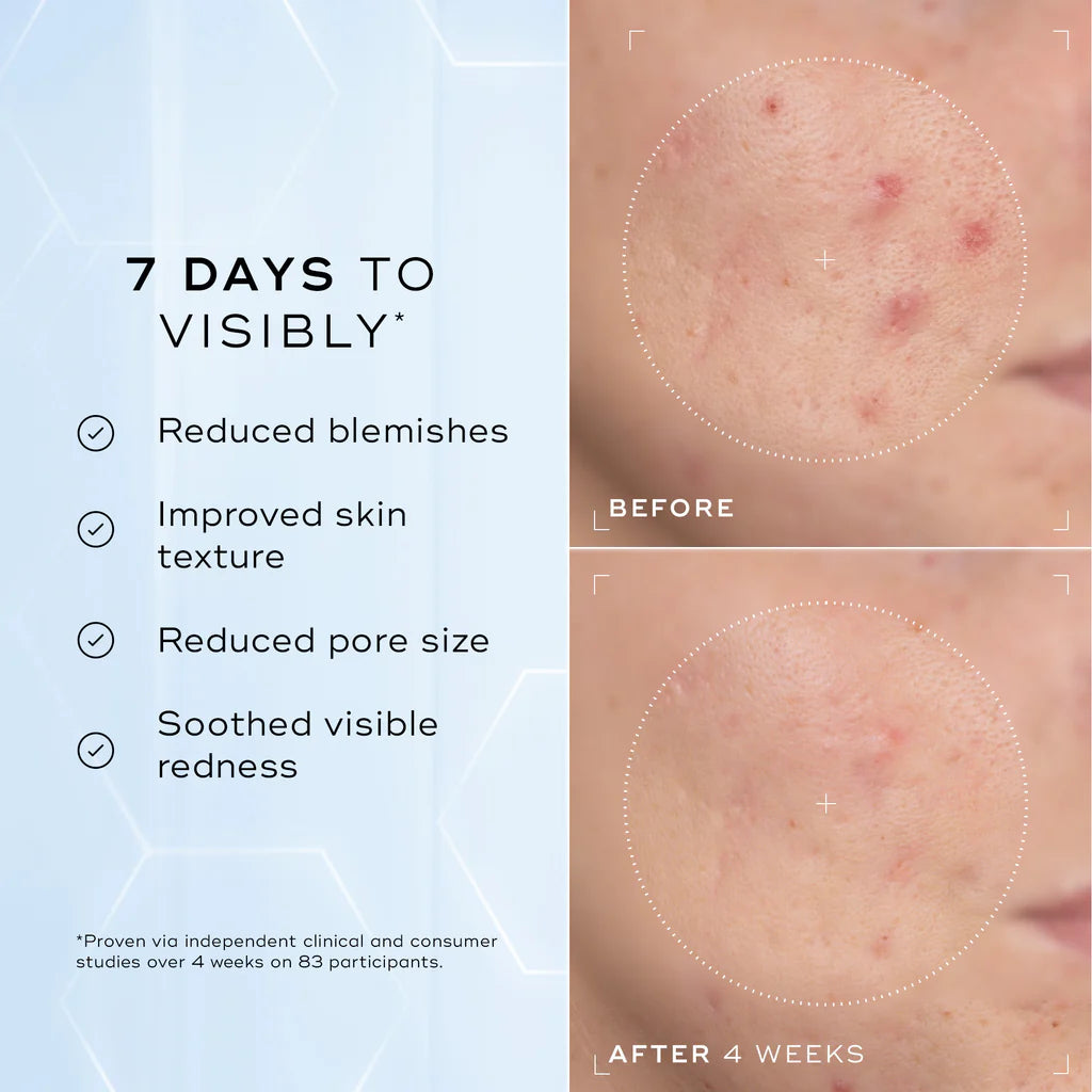 Medik8 niacinamide peptides before and afters