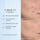 Medik8 niacinamide peptides before and afters