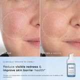 Medik8 niacinamide peptides before and after