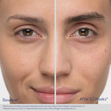 Obagi Nu Cil Eyebrow serum before and after