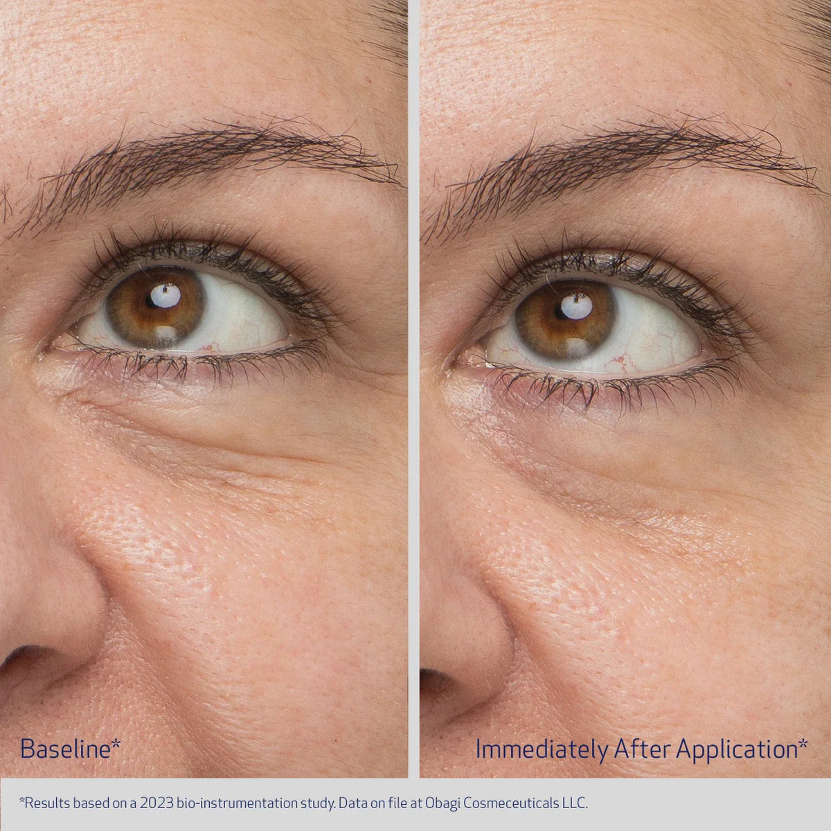 Obagi Daily Hydro Drops Rejuvenating Eye Gel Cream before and after