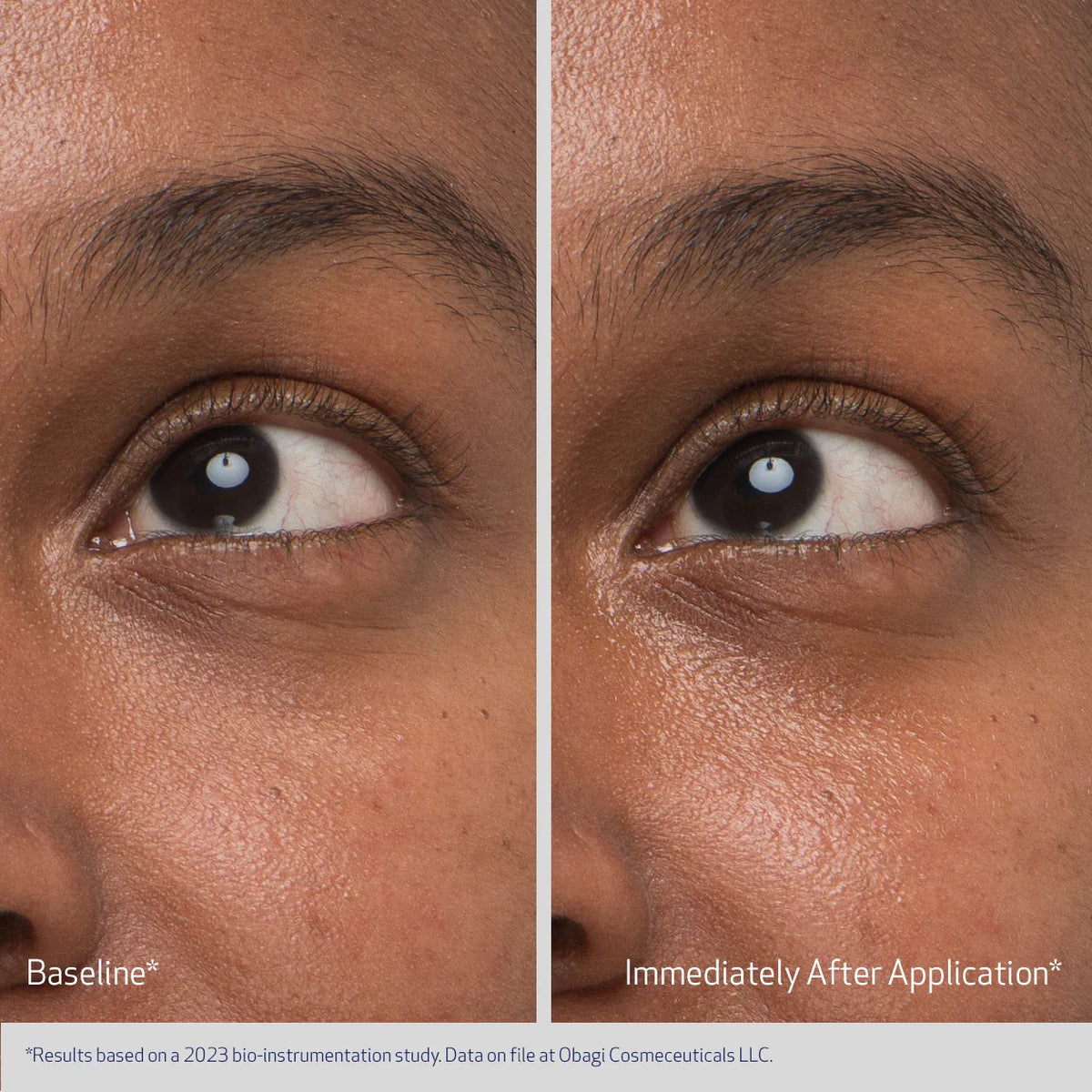 Obagi Daily Hydro Drops Rejuvenating Eye Gel Cream before and after