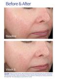 ZO Skin Health® Rozatrol