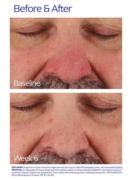 ZO Skin Health® Rozatrol