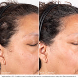 Obagi Nu Cil Scalp Serum before and after
